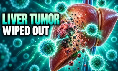 GPC3 CAR T therapy cleared toddler hepatoblastoma