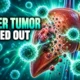 GPC3 CAR T therapy cleared toddler hepatoblastoma